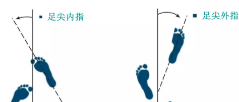 孩子走路“内八字/外八字”,长大以后会影响工作和生活吗?